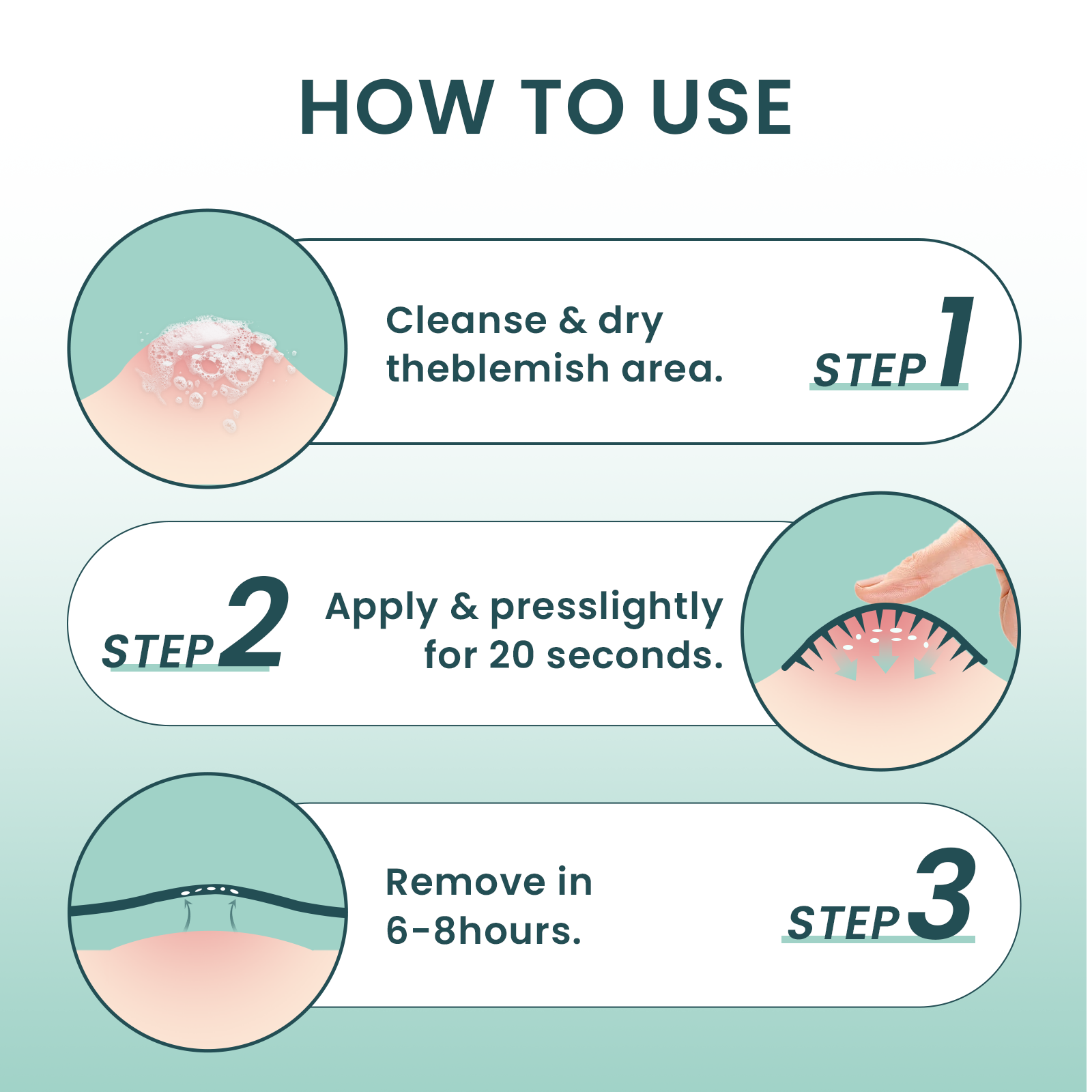 YOEYOU Micro-infusion Pimple Patches