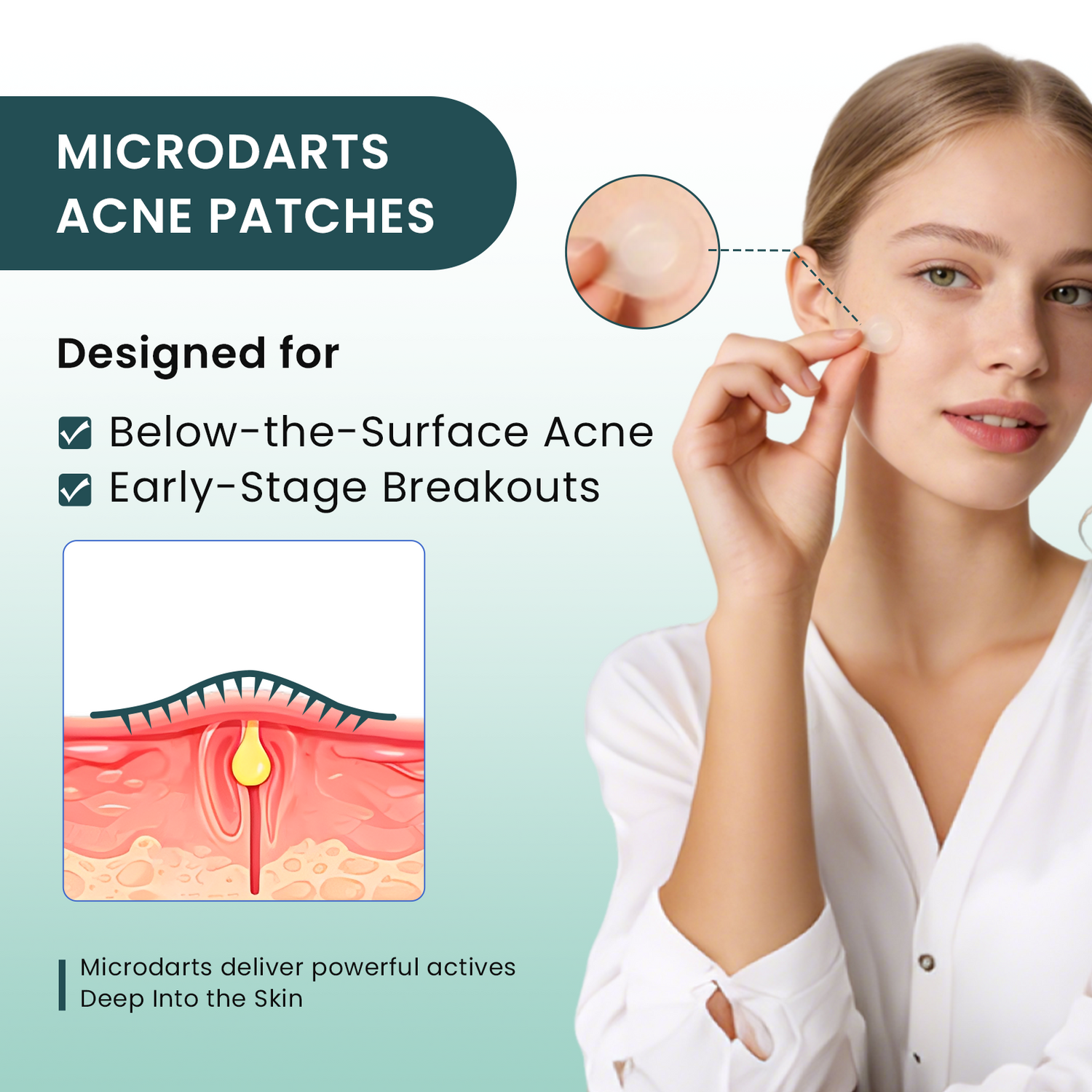 YOEYOU Micro-infusion Pimple Patches