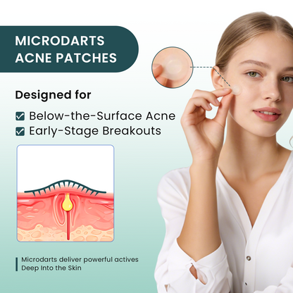 YOEYOU Micro-infusion Pimple Patches