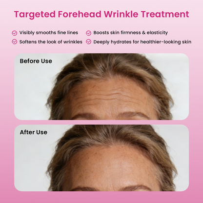 YOEYOU Micro-infusion Forehead Patches