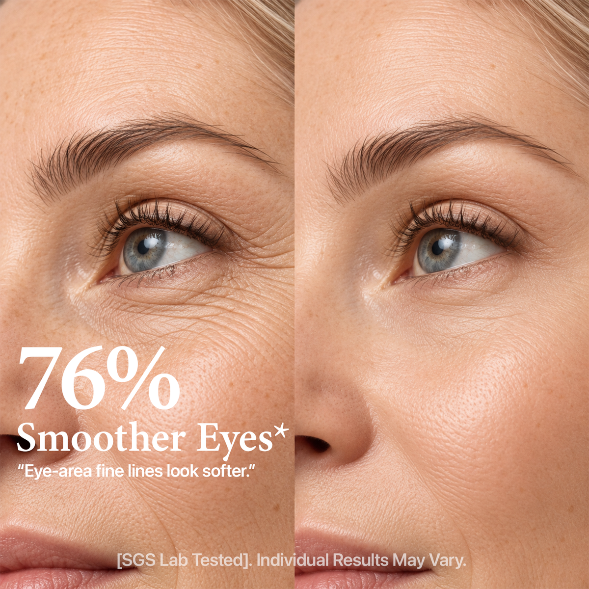 Yeoyou EMS Eye Lifting Device
