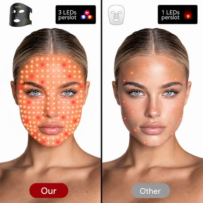 Yoeyou LED Red Light Therapy Mask