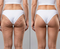 EMS Toning Shorts