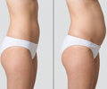 EMS Toning Shorts
