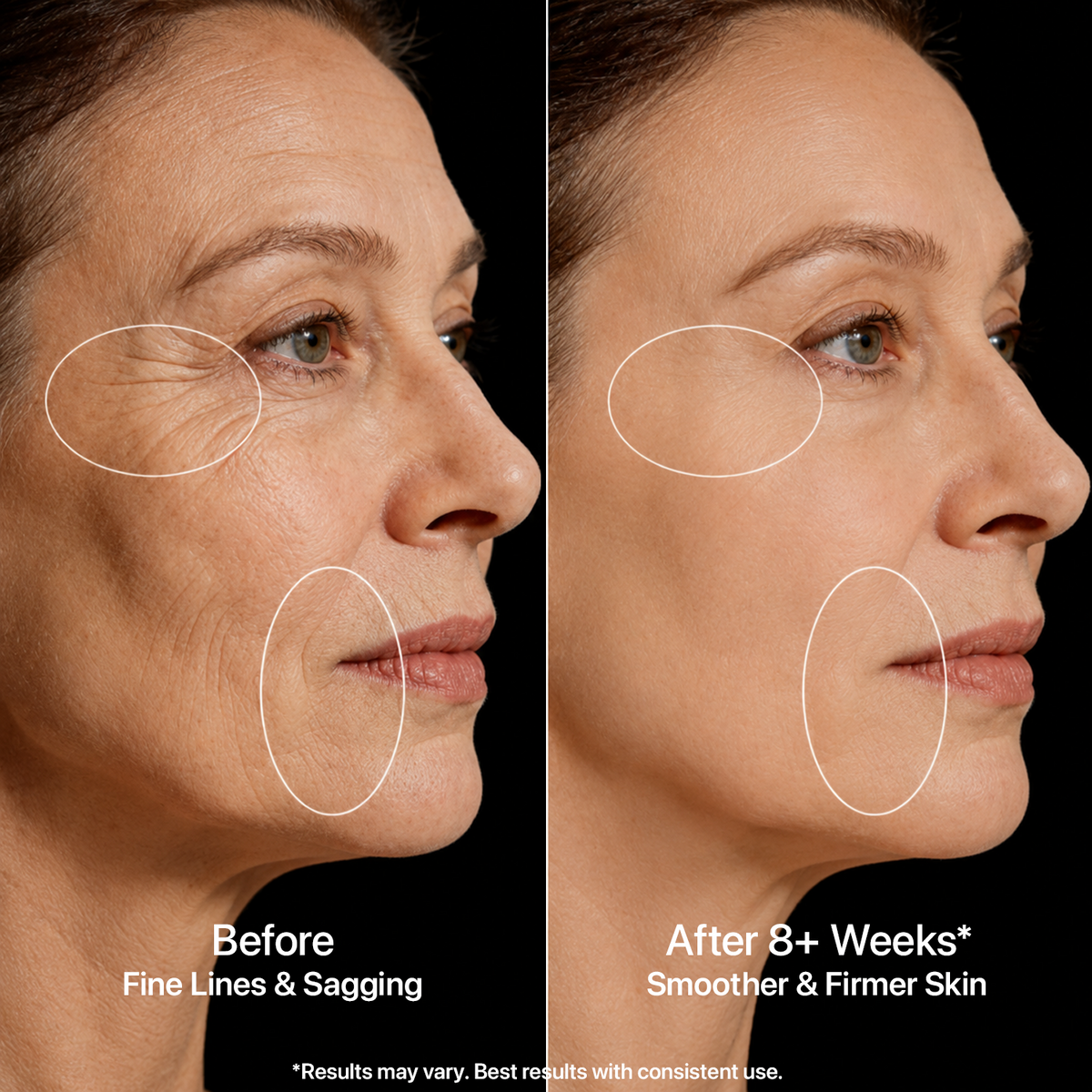 Yoeyou Pro 850nm LED Face and Neck Mask
