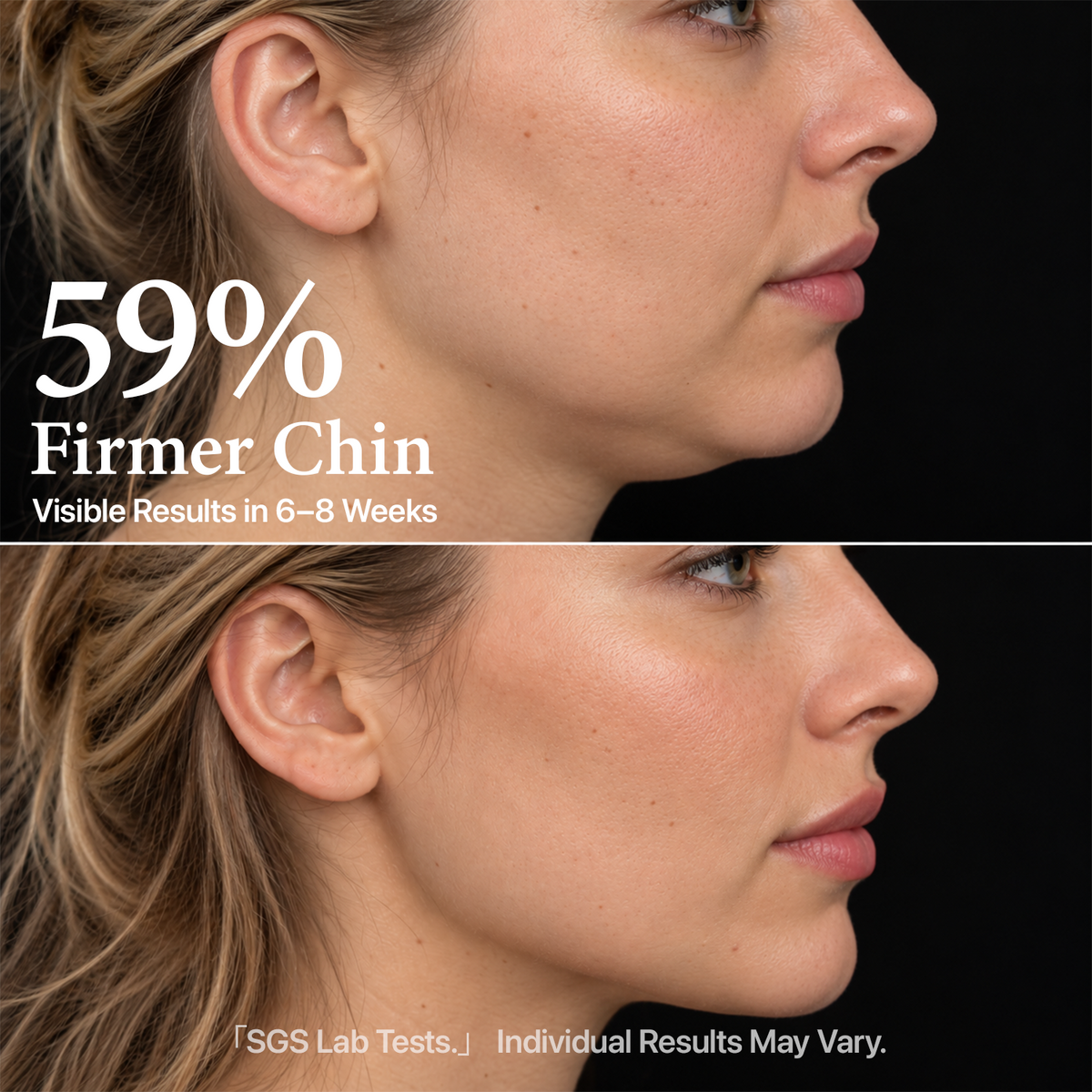 Yoeyou EMS Facial Lifting Device
