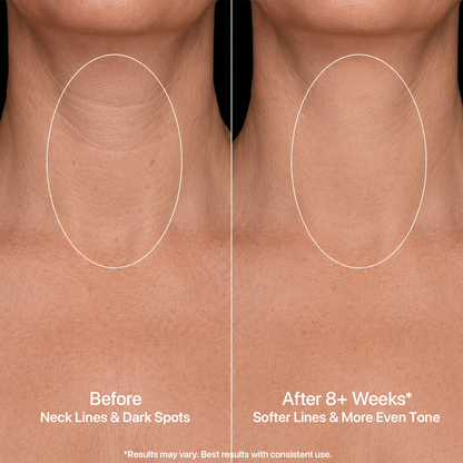 Yoeyou Pro 850nm LED Face and Neck Mask